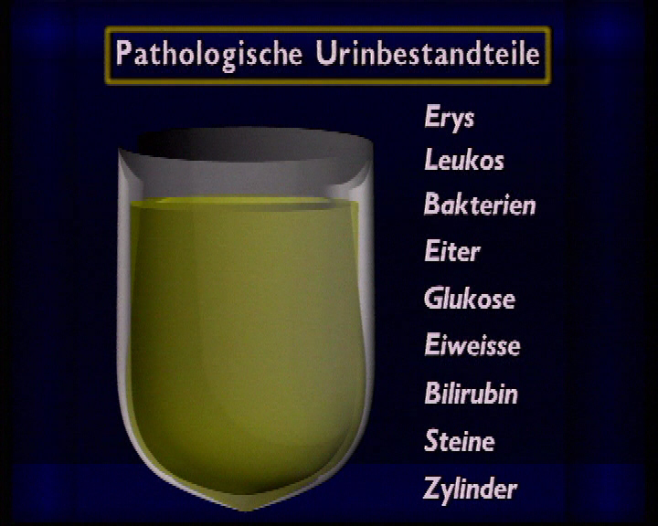 pathologische urinbestandteile