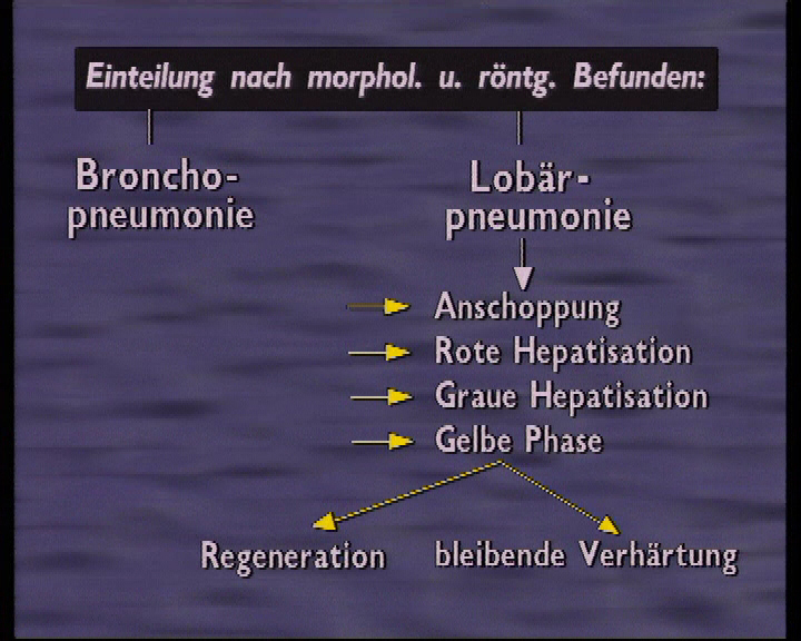 bronchopneumonie 