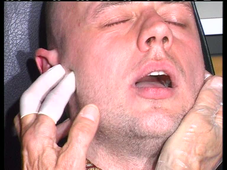 Mundakupunktur-Palpation-Kiefergelenk