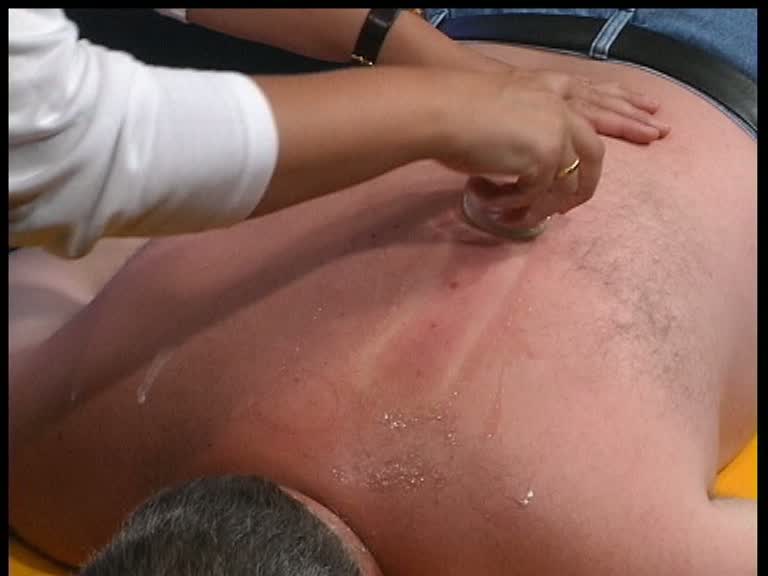 schroepfmassage