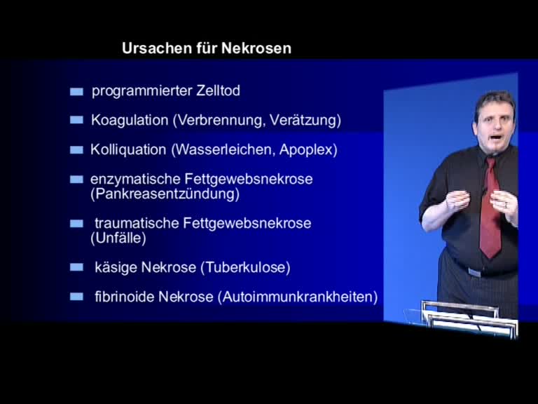 fibrinoide nekrosen 