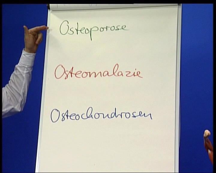 osteoporose Osteomalazie 