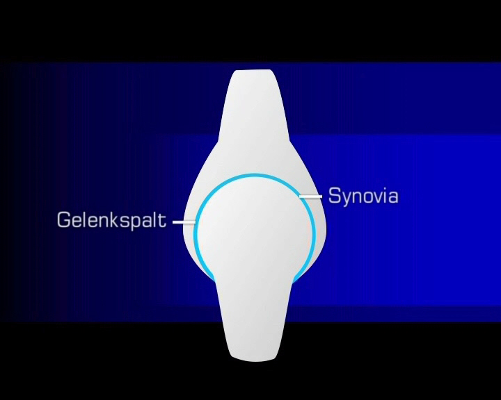 gelenkspalt synovia