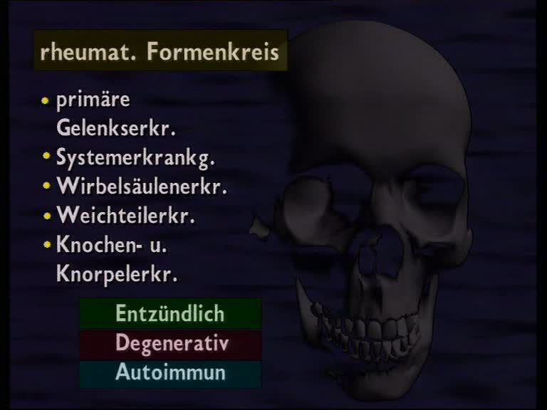 rheumatischer formenkreis 