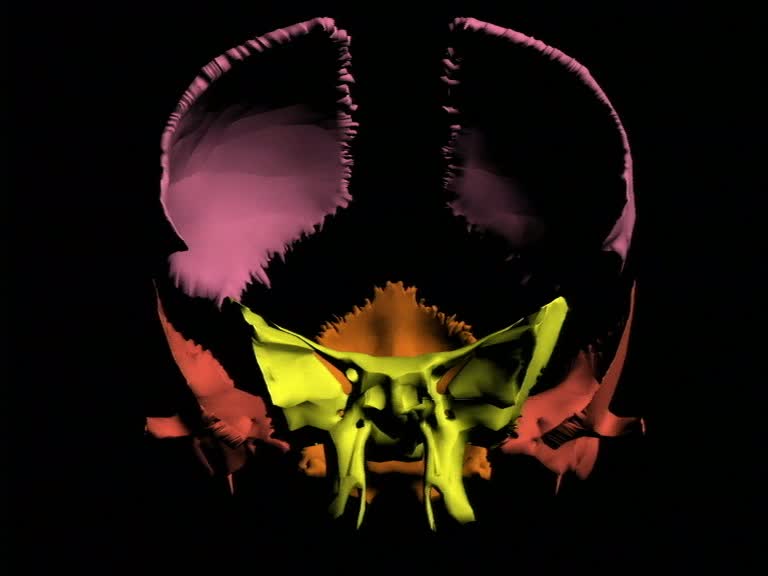 cerebrospinalis schaedelknochen 