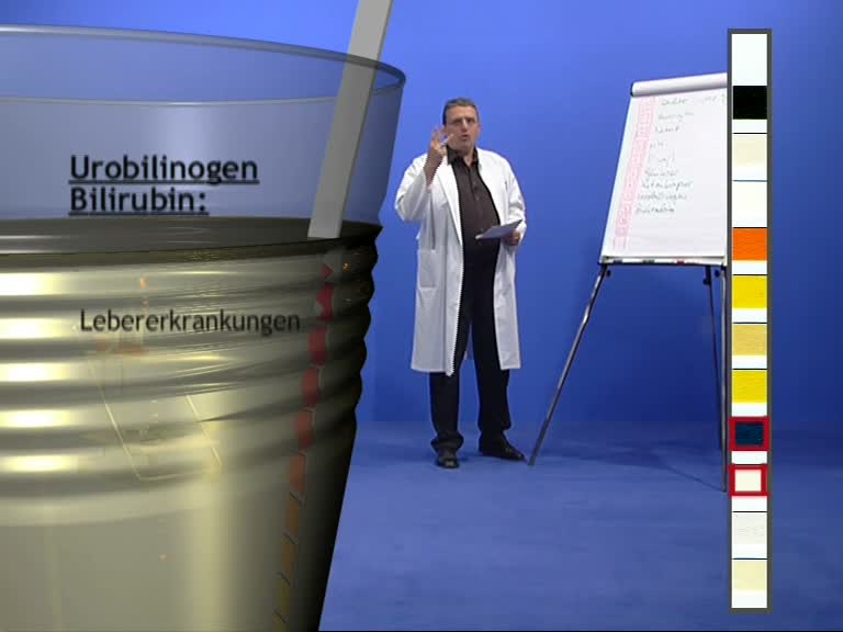 uobilinogen 