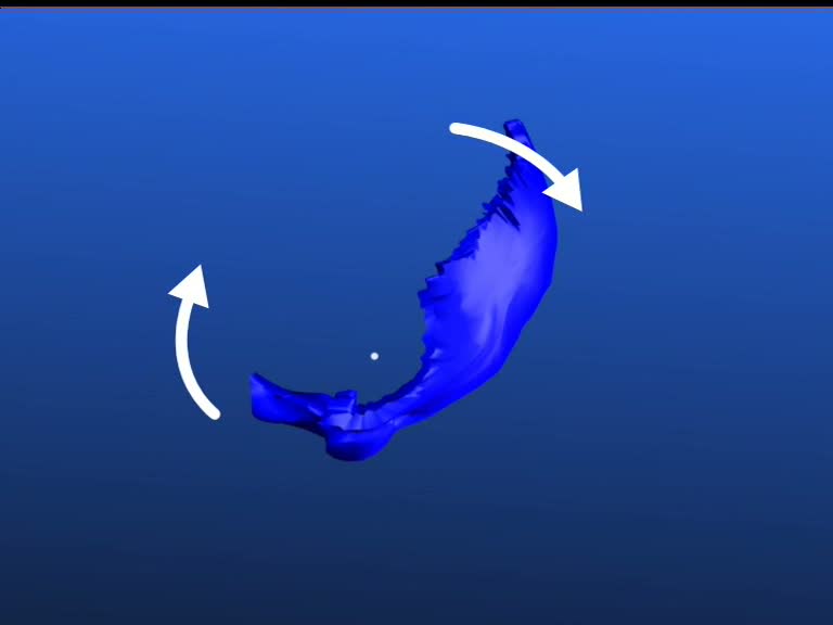 sphenoid bone pterygoid processes move posterial