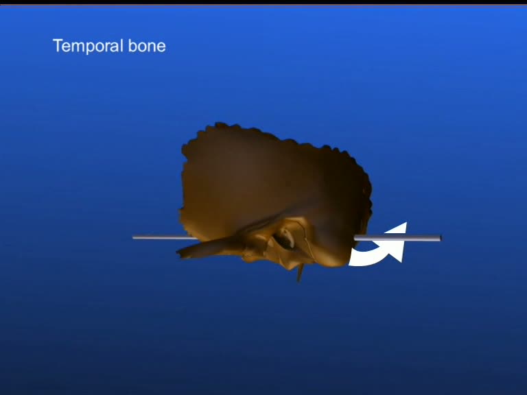 emporal bone magoun