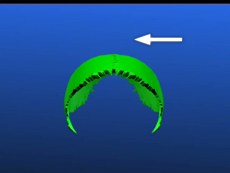 treatment compression point of balance homeodynamic forces 