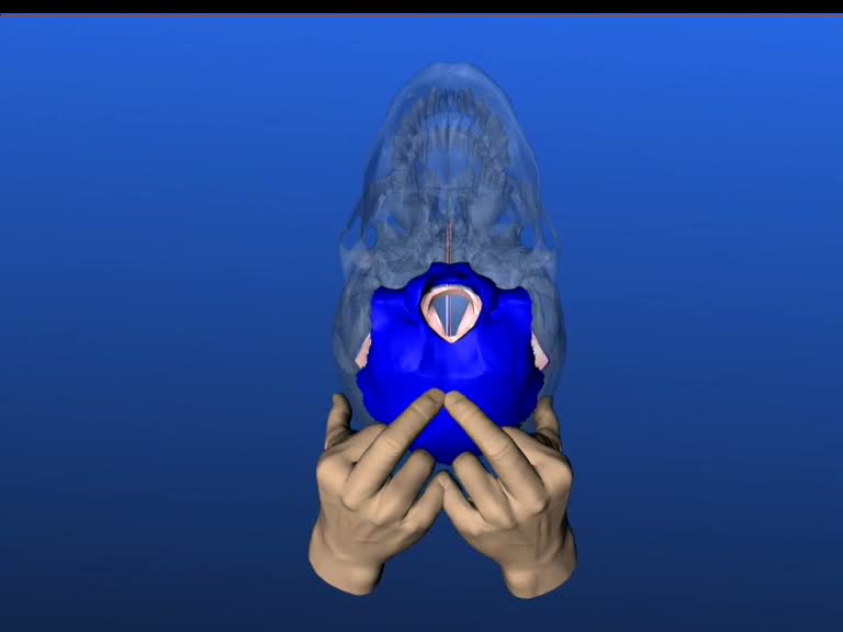 venous sinus techniques occipital sinus