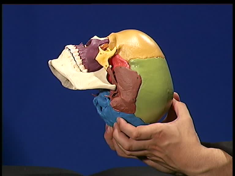 venous sinus techniques transverse sinus straight sinus