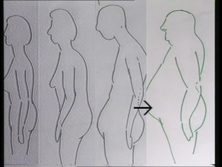 haltungsformen bauch