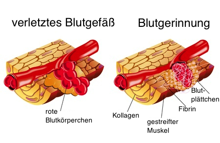 Urheber: <a href='http://de.123rf.com/profile_rob3000'>rob3000 / 123RF Lizenzfreie Bilder</a>
