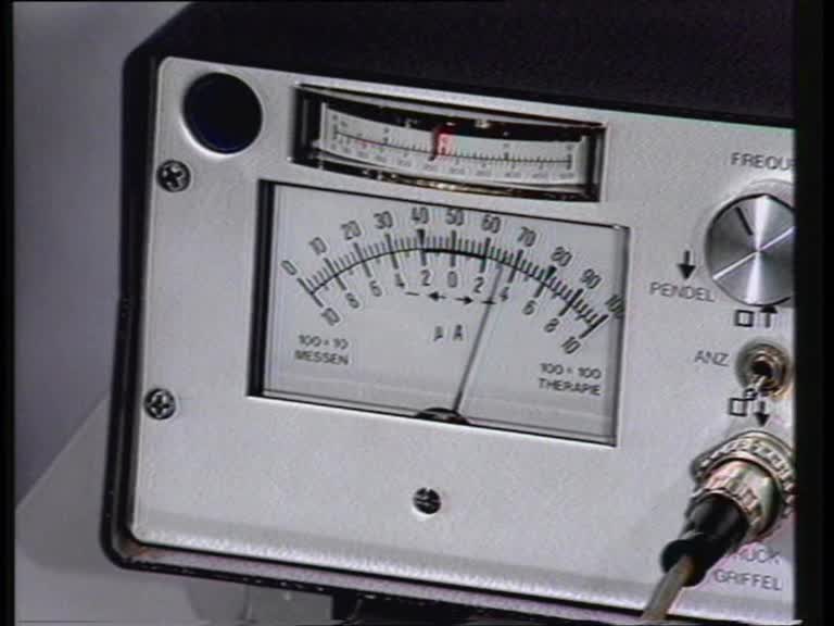 elektroakupunkturtest handpunkte