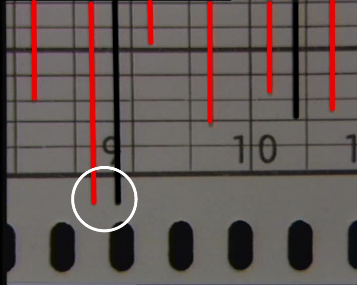 elektroakupunkturtest balkengrafik extremwert