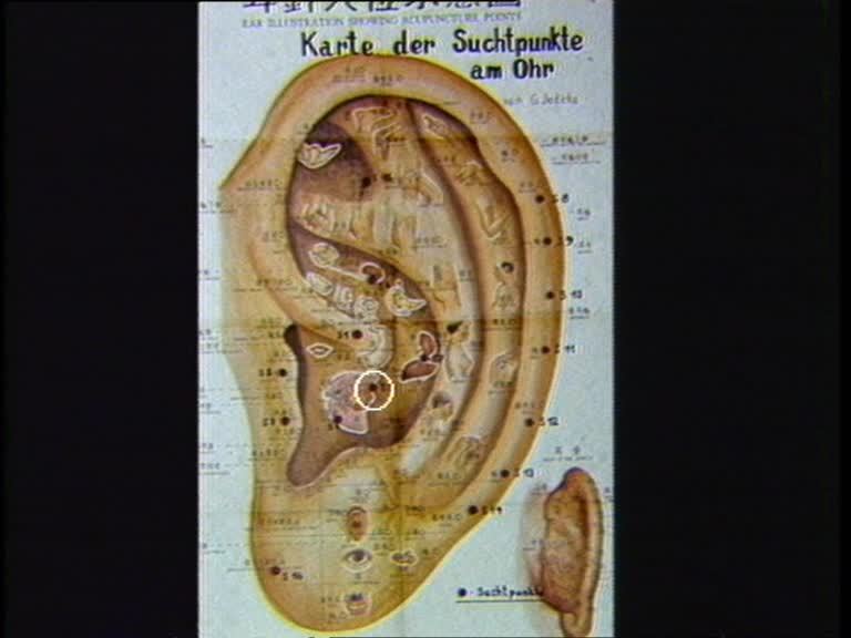 akupunktur suchtpunkte