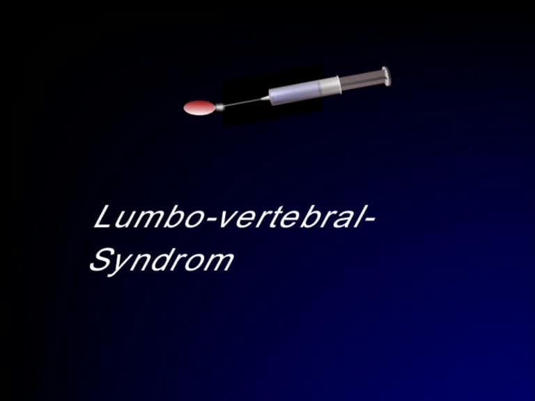 hautquaddel lumbovertebralsyndrom